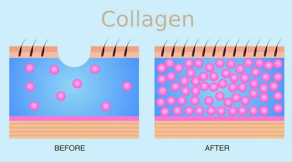 Kolagen Design Vektoru Kůže — Stockový vektor