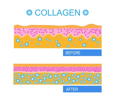 Kolajen, Koruma Cildi vektör tasarımı.