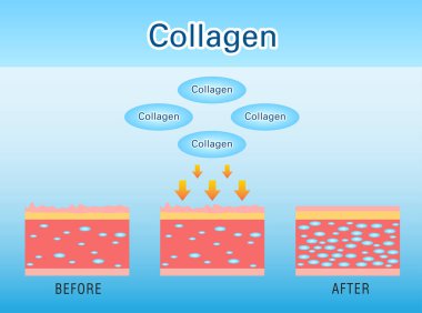 Kolajen, Koruma Cildi Vektörü.