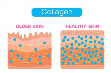Kolajen, eski cilt ve sağlıklı cilt, Koruma Cildi, vektör tasarımı