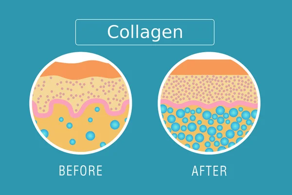 Colágeno Protección Vector Piel — Archivo Imágenes Vectoriales