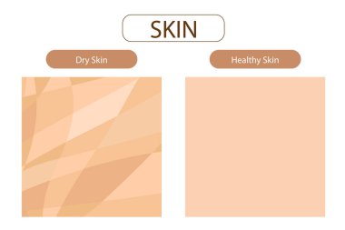 kuru cilt ve sağlıklı cilt, güzellik ve sağlık hizmetleri, vektör tasarımı.