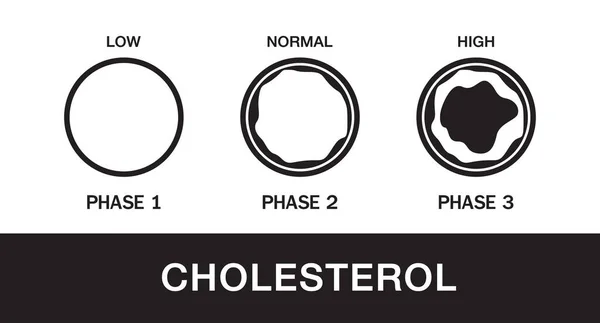 Colesterolo Nell Arteria Rischio Salute Progettazione Vettoriale — Vettoriale Stock