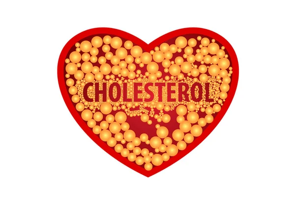 Cholesterol Tętnicy Zagrożenie Dla Zdrowia Konstrukcja Wektora — Wektor stockowy