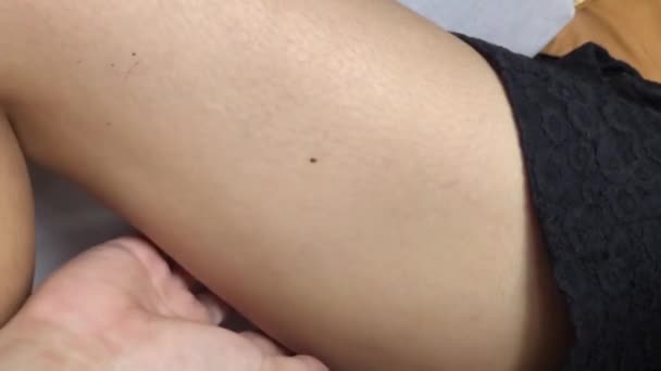 Slow Motion Cellulitis Mollig Vrouw Been Beweging — Stockvideo