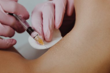 Cerrah elleri eldivenle kadın boynuna gençleştirici sıvı enjekte ediyor