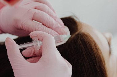 Enjeksiyon alma saç dökülmesi sorunu olan genç kadın