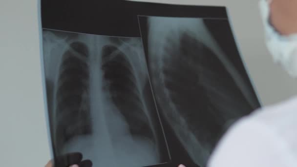 Il medico guarda una radiografia dei polmoni della covid-19 — Video Stock