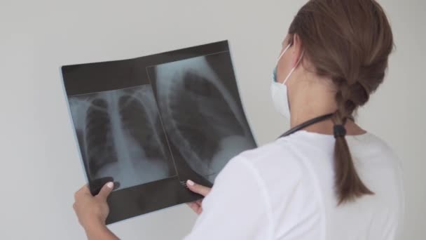 Γυναίκα γιατρός εξετάζει X-ray των πνευμόνων που επηρεάζονται από covid-19, — Αρχείο Βίντεο