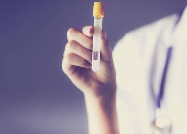 Laboratuvarda ya da laboratuvarda test tüpüne bakarak kadın tıbbi ya da araştırma uzmanı ya da doktor.