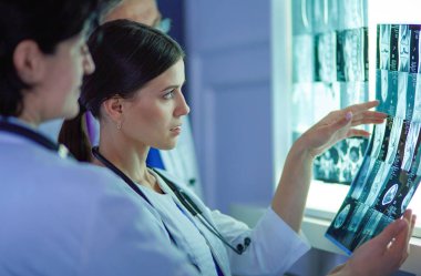 Bir grup doktor bir klinikte röntgenleri inceliyor, teşhis koymayı düşünüyorlar.