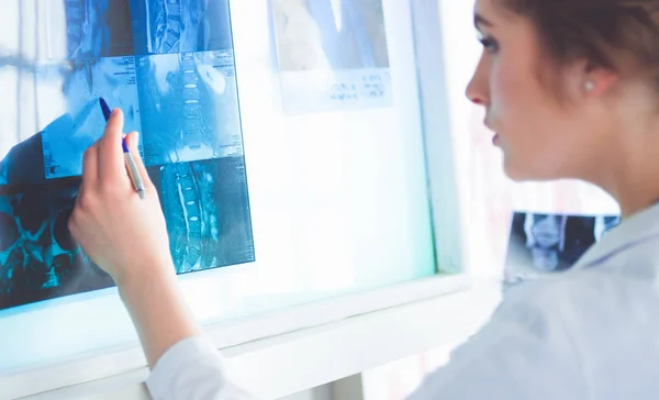 Junge Ärztin betrachtet Röntgenbild der Lungen im Krankenhaus — Stockfoto