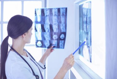 Stetoskop lu genç gülümseyen kadın doktor doktor ofisinde röntgeni işaret ediyor