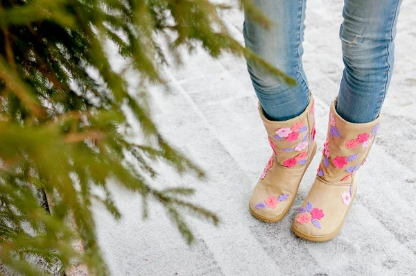 Jambes Une Fille Lors Une Promenade Hivernale — Photo