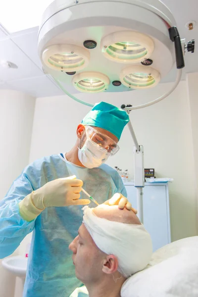 O cirurgião dá injeções na cabeça. Tratamento da calvície. Transplante de cabelo. Cirurgiões na sala de cirurgia realizar cirurgia de transplante de cabelo. Técnica cirúrgica que move os folículos pilosos de um — Fotografia de Stock