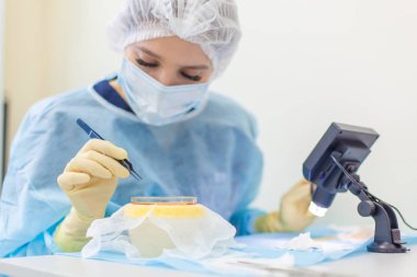 Mikroskop altındaki doktor saç köklerini yeniden hesaplar. Kellik tedavisi. Saç ekimi. Ameliyathanedeki cerrahlar saç nakli ameliyatı gerçekleştirin. Hareket eden cerrahi teknik