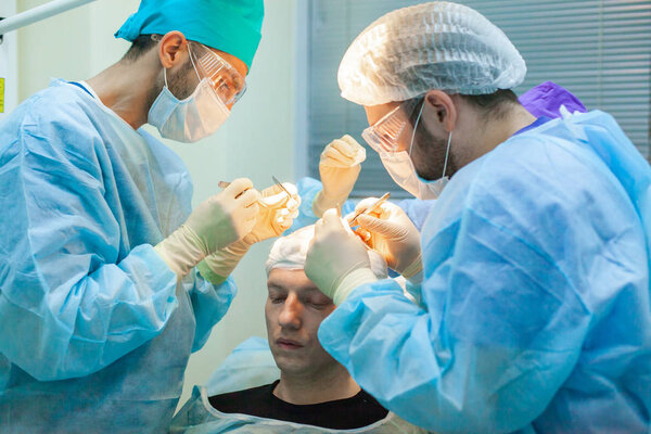 Baldness treatment. Hair transplant. Surgeons in the operating room carry out hair transplant surgery. Surgical technique that moves hair follicles from a part of the head.