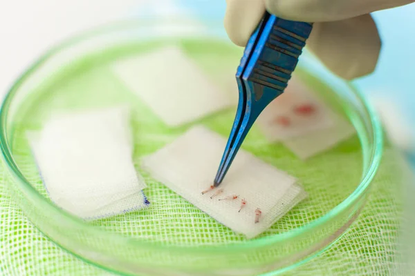 Hair follicles in the Cup close-up. Baldness treatment. Hair transplant. Surgeons in the operating room carry out hair transplant surgery. Surgical technique that moves hair follicles from a part of — Stock Photo, Image