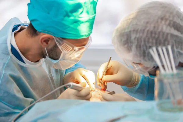 Tratamiento de la calvicie. Trasplante de cabello. Los cirujanos en el quirófano llevan a cabo una cirugía de trasplante de cabello. Técnica quirúrgica que mueve los folículos pilosos de una parte de la cabeza . — Foto de Stock