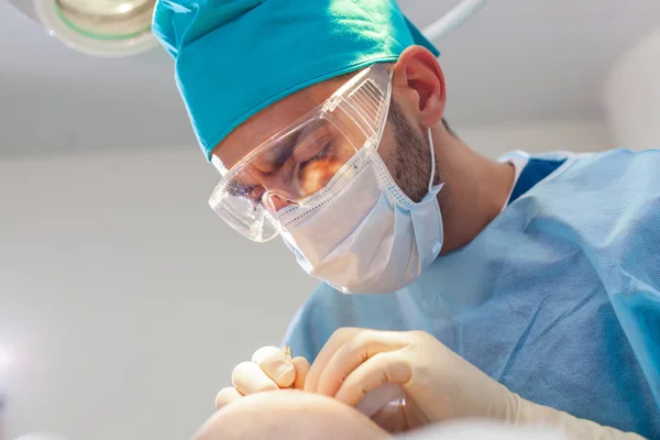 Glatzenbehandlung. Haartransplantation. Chirurgen im Operationssaal führen Haartransplantationen durch. Chirurgische Technik, die Haarfollikel aus einem Teil des Kopfes entfernt. — Stockfoto
