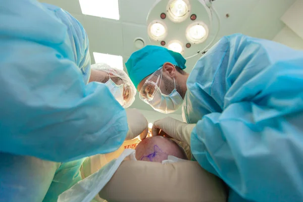 Baldness treatment. Hair transplant. Surgeons in the operating room carry out hair transplant surgery. Surgical technique that moves hair follicles from a part of the head.