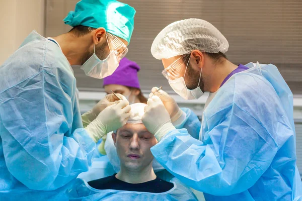 Leczenie łysienia. Przeszczep włosów. Chirurdzy w sali operacyjnej przeprowadzają operację przeszczepu włosów. Technika chirurgiczna, która przenosi mieszki włosowe z części głowy. — Zdjęcie stockowe
