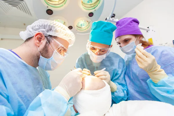 Skallighet behandling. Hårtransplantation. Kirurger i operationssalen utför hår transplantationskirurgi. Kirurgisk teknik som flyttar hårsäckarna från en del av huvudet. — Stockfoto