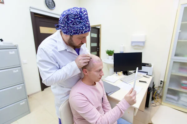 Leczenie łysienia. Pacjent cierpi na wypadanie włosów w porozumieniu z lekarzem. Przygotowanie do zabiegu transplantacji włosów. Linia oznaczania wzrostu włosów. Pacjent kontroluje oznakowanie w — Zdjęcie stockowe