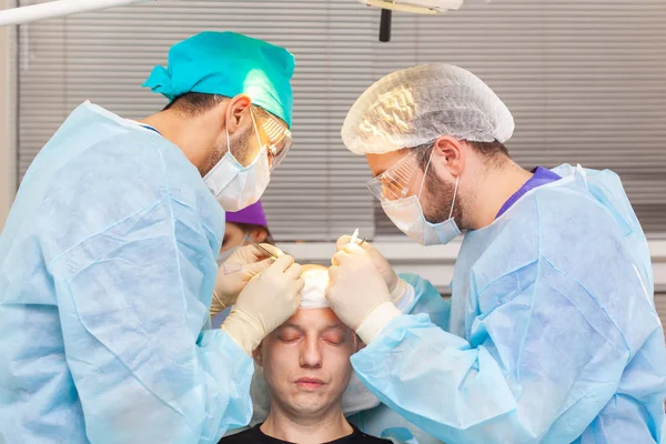 Baldness treatment. Hair transplant. Surgeons in the operating room carry out hair transplant surgery. Surgical technique that moves hair follicles from a part of the head.