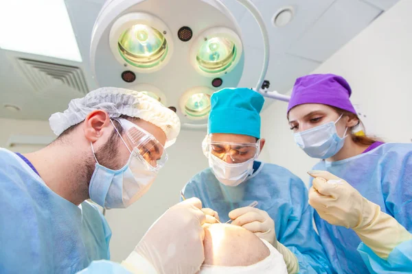 Tratamiento de la calvicie. Trasplante de cabello. Los cirujanos en el quirófano llevan a cabo una cirugía de trasplante de cabello. Técnica quirúrgica que mueve los folículos pilosos de una parte de la cabeza . — Foto de Stock