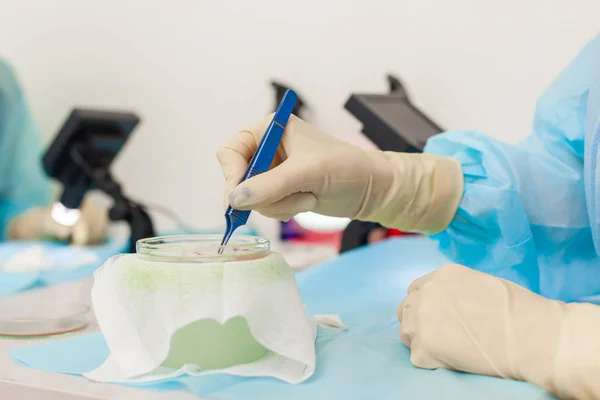 Der Arzt unter dem Mikroskop berechnet die Haarfollikel neu. Glatzenbehandlung. Haartransplantation. Chirurgische Technik, die Haarfollikel aus einem Teil des Kopfes entfernt. — Stockfoto