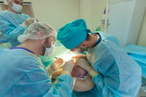 Skallighet behandling. Hårtransplantation. Kirurger i operationssalen utför hår transplantationskirurgi. Kirurgisk teknik som flyttar hårsäckarna från en del av huvudet. — Stockfoto