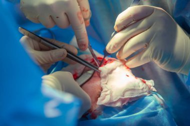 Cerrah ve hastane ameliyathane burnuna estetik ameliyat asistanı. Burnun yeniden şekillendirilmesi, büyütme. Burun estetiği.