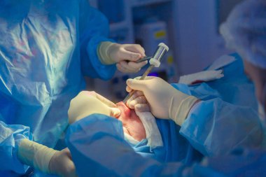 Cerrah ve asistanı hastane ameliyathanede burun üzerinde kozmetik cerrahi gerçekleştiriyor. Burun yeniden şekillendirme, augmentasyon. Rinoplasti. Çekiç.