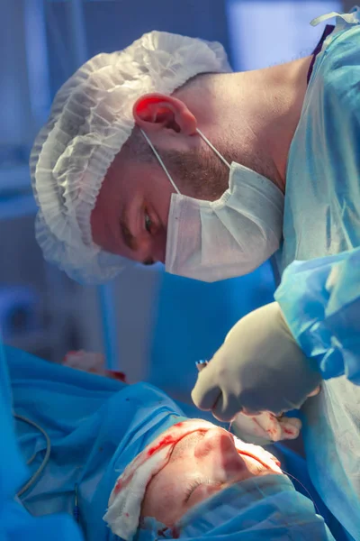 Cirurgião e seu assistente realizando cirurgia estética no nariz na sala de cirurgia do hospital. Reformulação do nariz, aumento. Rinoplastia . — Fotografia de Stock