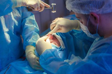 Cerrah ve asistanı hastane ameliyathanede burun üzerinde kozmetik cerrahi gerçekleştiriyor. Burun yeniden şekillendirme, augmentasyon. Rinoplasti. Çekiç.