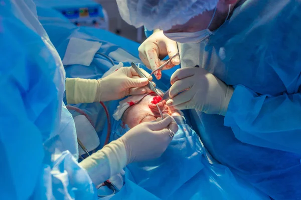 Surgeon and his assistant performing cosmetic surgery on nose in hospital operating room. Nose reshaping, augmentation. Rhinoplasty.