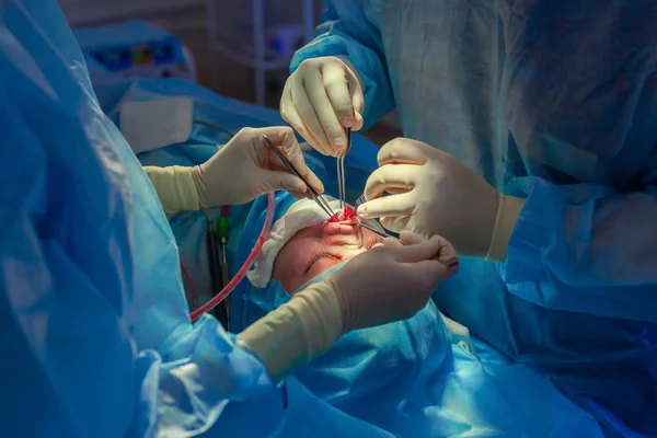 Surgeon and his assistant performing cosmetic surgery on nose in hospital operating room. Nose reshaping, augmentation. Rhinoplasty. — Stock Photo, Image