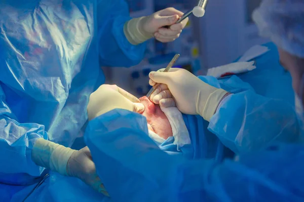 Cirurgião e seu assistente realizando cirurgia estética no nariz na sala de cirurgia do hospital. Reformulação do nariz, aumento. Rinoplastia. Martelo . — Fotografia de Stock