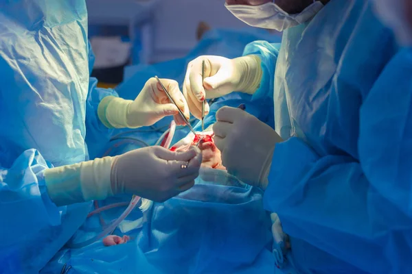 Cirurgião e seu assistente realizando cirurgia estética no nariz na sala de cirurgia do hospital. Reformulação do nariz, aumento. Rinoplastia . — Fotografia de Stock