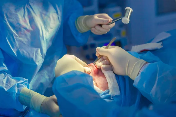 Cerrah ve asistanı hastane ameliyathanede burun üzerinde kozmetik cerrahi gerçekleştiriyor. Burun yeniden şekillendirme, augmentasyon. Rinoplasti. Çekiç.