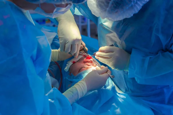 Surgeon and his assistant performing cosmetic surgery on nose in hospital operating room. Nose reshaping, augmentation. Rhinoplasty. — Stock Photo, Image