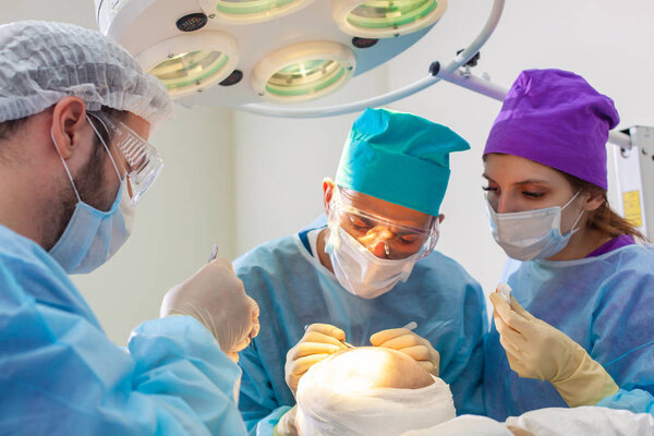 Baldness treatment. Hair transplant. Surgeons in the operating room carry out hair transplant surgery. Surgical technique that moves hair follicles from a part of the head.