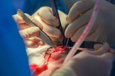 Cerrah ve hastane ameliyathane burnuna estetik ameliyat asistanı. Burnun yeniden şekillendirilmesi, büyütme. Burun estetiği.