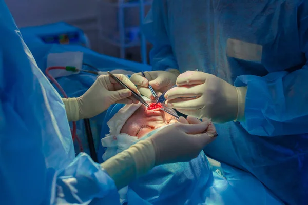 Chirurg en zijn assistent uitvoeren van cosmetische chirurgie op neus in ziekenhuis operatiekamer. Neus omvormen, augmentatie. Neuscorrectie. — Stockfoto