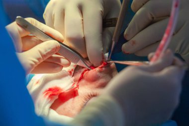 Cerrah ve hastane ameliyathane burnuna estetik ameliyat asistanı. Burnun yeniden şekillendirilmesi, büyütme. Burun estetiği.