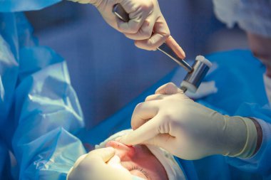 Cerrah ve asistanı hastane ameliyathanede burun üzerinde kozmetik cerrahi gerçekleştiriyor. Burun yeniden şekillendirme, augmentasyon. Rinoplasti. Çekiç.