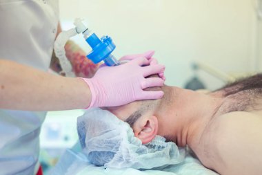 Anestezist operasyon odasında trakeal entübasyonu yapıyor. Ameliyat hazırlığı. Rinoplasti