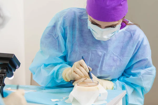 Läkaren under mikroskopet beräknar om hår säckarna. Skallighet behandling. Hår transplantation. Kirurgisk teknik som flyttar hår säckarna från en del av huvudet. — Stockfoto