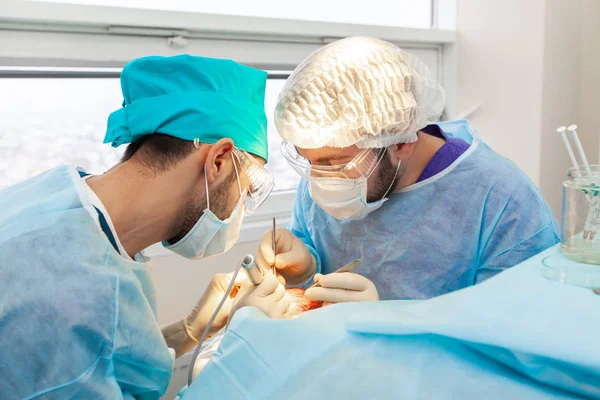 Tratamiento de la calvicie. Trasplante de cabello. Los cirujanos en el quirófano llevan a cabo una cirugía de trasplante de cabello. Técnica quirúrgica que mueve los folículos pilosos de una parte de la cabeza . — Foto de Stock